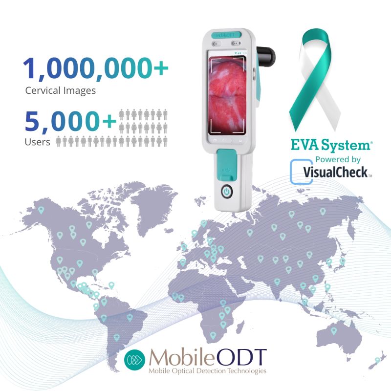 EVA Smart Colposcope