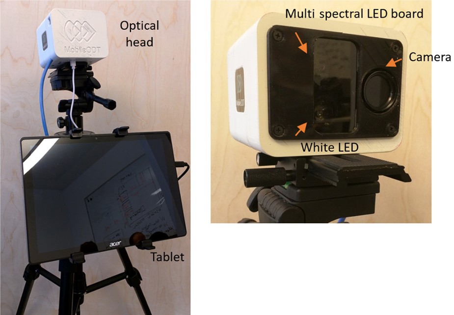 Multispectral colposcopy system